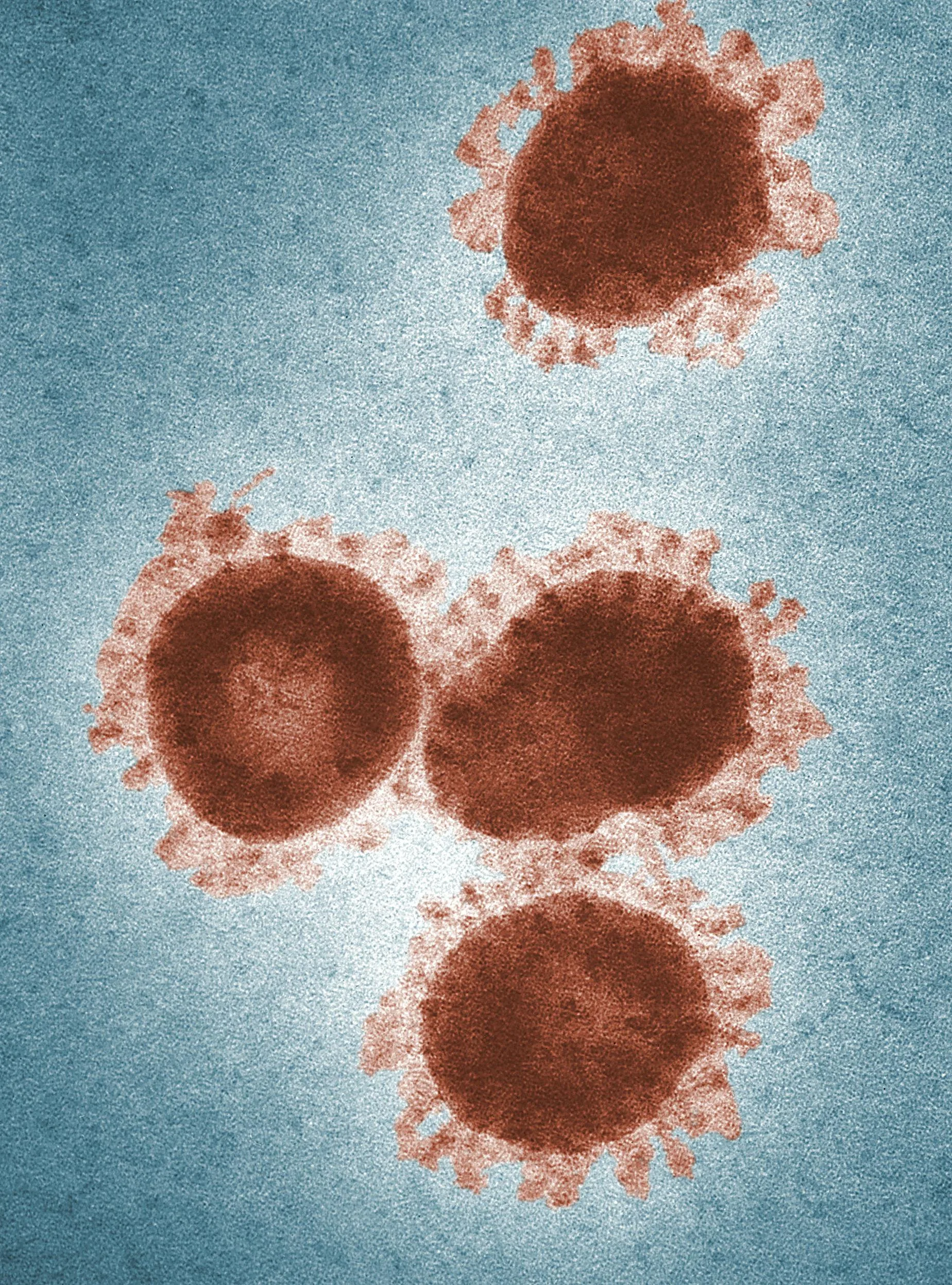 hmpv virus outbreak img